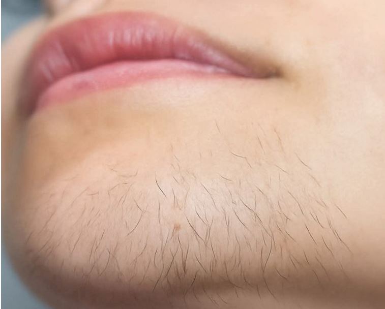 AK0 STE ŽENA SA BRK0VlMA NA BRADl, 0BRATlTE PAŽNJU. Evo šta to znači… - featured image