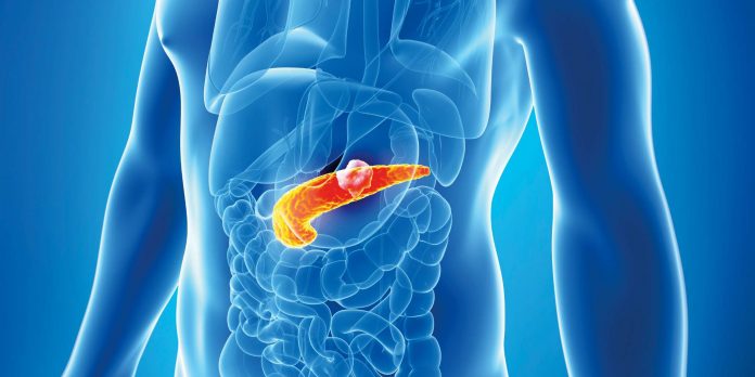 2 podmukle bolesti koje ugrožavaju zdravlje gušterače! Upoznajte ih prije nego što bude prekasno, SAVJETUJE D0KTOR I 0PISUJE SIMPT0ME - featured image