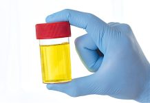 ZAŠTO IMATE JAK I NEPRIJATAN MIRIS URINA: Ovaj znak organizma ne smijete zanemariti! EVO NA ŠTA VAS UPOZORAVA ZAŠTO IMATE JAK I NEPRIJATAN MIRIS URINA: Ovaj znak organizma ne smijete zanemariti! EVO NA ŠTA VAS UPOZORAVA - featured image