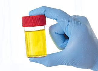 ZAŠTO IMATE JAK I NEPRIJATAN MIRIS URINA: Ovaj znak organizma ne smijete zanemariti! EVO NA ŠTA VAS UPOZORAVA ZAŠTO IMATE JAK I NEPRIJATAN MIRIS URINA: Ovaj znak organizma ne smijete zanemariti! EVO NA ŠTA VAS UPOZORAVA - featured image