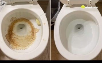 Nije sirÄe ni soda bikarbona: Ovo sredstvo najbolje uklanja kamenac u WC Å”olji Nije sirÄe ni soda bikarbona: Ovo sredstvo najbolje uklanja kamenac u WC Å”olji - featured image