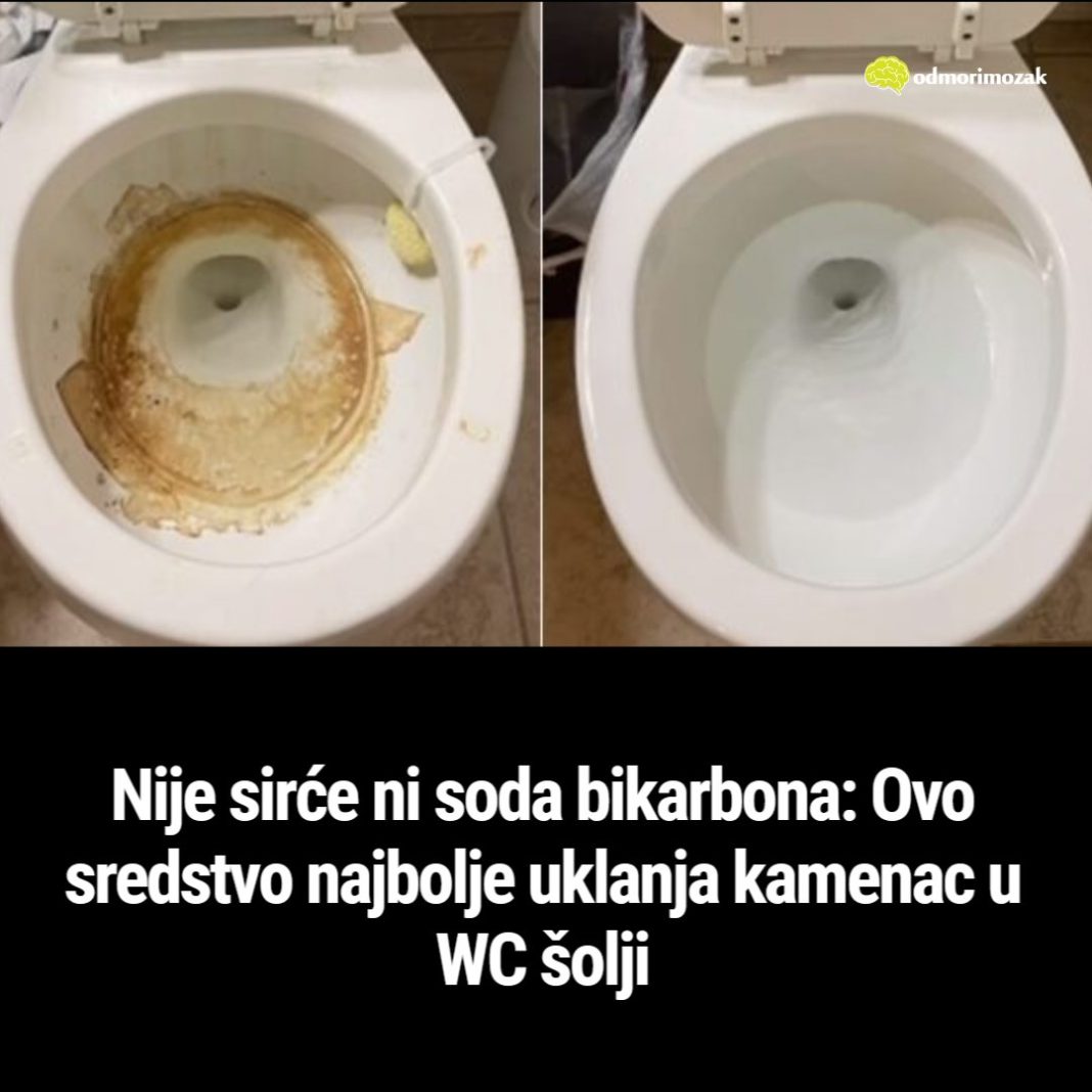 Nije sirće ni soda bikarbona: Ovo sredstvo najbolje uklanja kamenac u WC šolji - featured image Nije sirće ni soda bikarbona: Ovo sredstvo najbolje uklanja kamenac u WC šolji - featured image