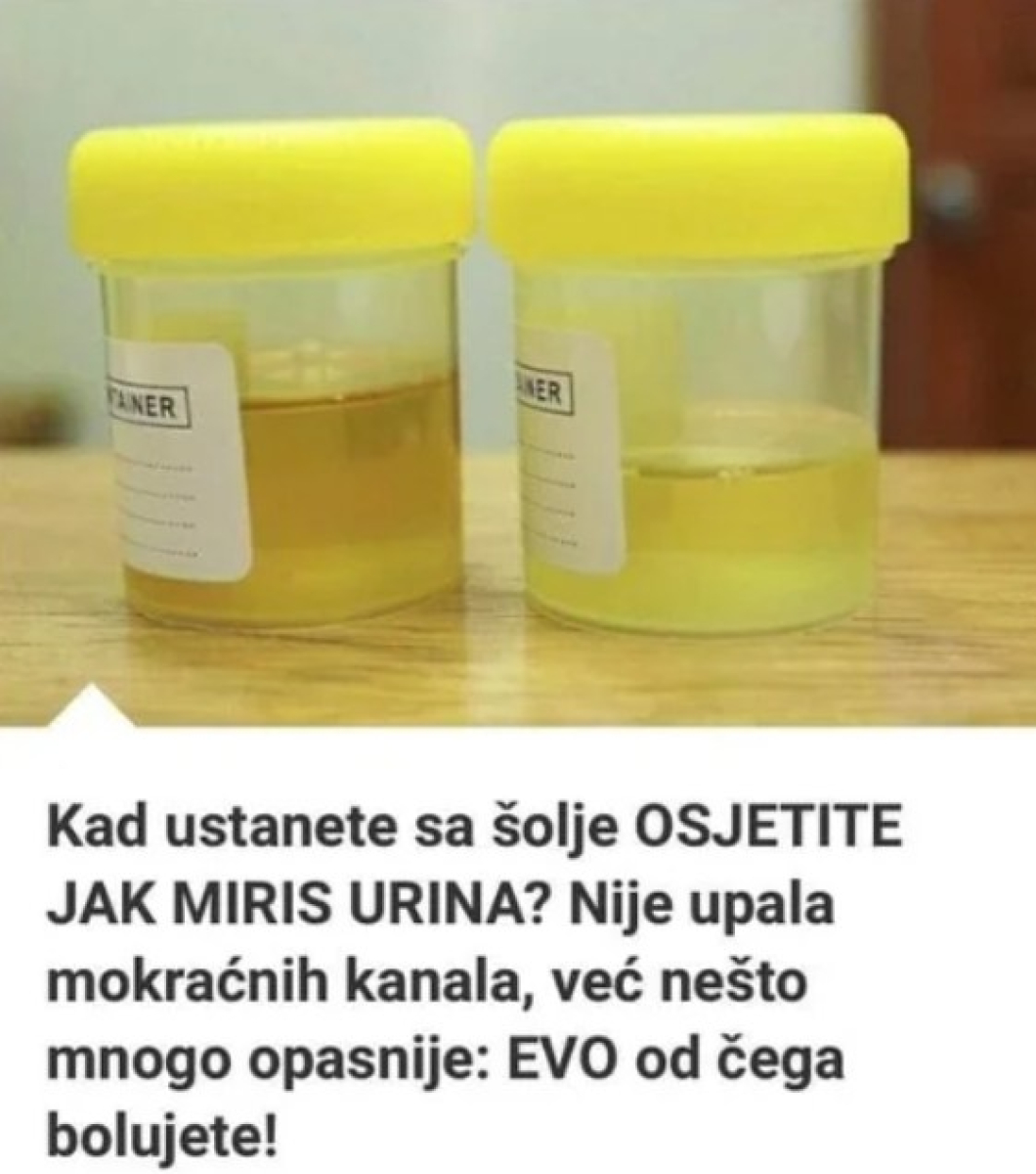 OSJETlTE Ll JAK MlRlS URlNA? To nije infekcija urinarnog trakta, već mnogo opasnije stanje koje IMATE… - featured image