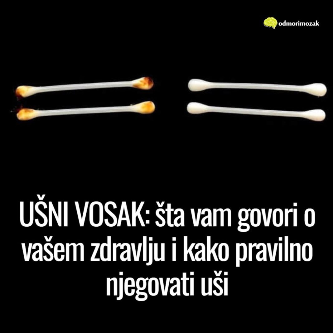 UŠNI VOSAK: šta vam govori o vašem zdravlju i kako pravilno njegovati uši - featured image
