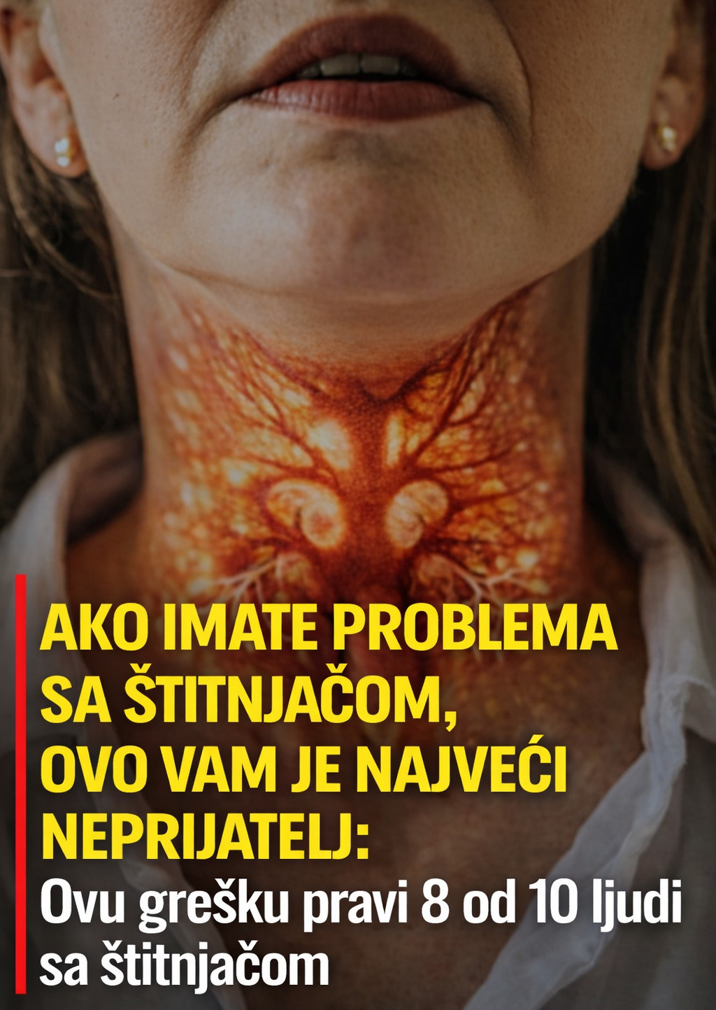 Ako imate problema sa štitnjačom, OVO vam je najveći neprijatelj: Ovu grešku pravi 8 od 10 ljudi sa štitnjačom - featured image