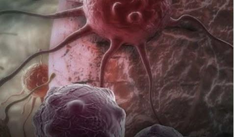 Dvije namirnice ubrzavaju starenje i podstiču rak: Izbjegavajte ih nakon 40. godine - featured image