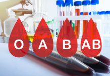 Liječnici otkrili koja krvna grupa ima najmanji rizik od raka Liječnici otkrili koja krvna grupa ima najmanji rizik od raka - featured image