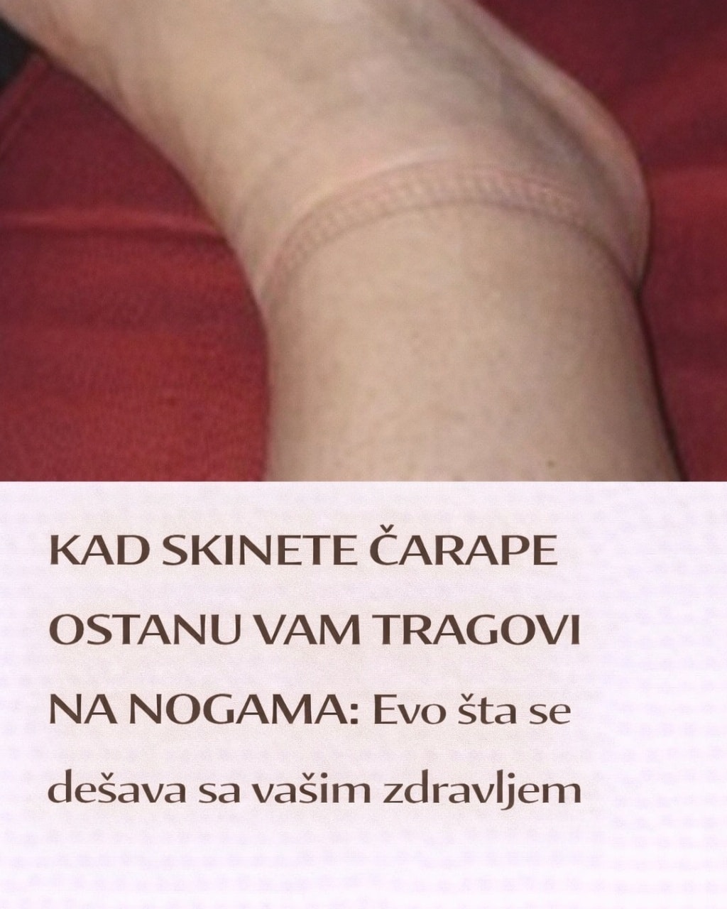 Kad skinete čarape ostanu vam tragovi na nogama: evo šta se dešava sa vašim zdravljem - featured image