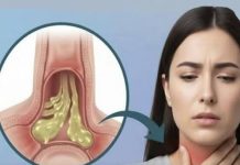 Kako ublažiti sluz u grlu: bezbedni i prirodni saveti za svakodnevno olakšanje Kako ublažiti sluz u grlu: bezbedni i prirodni saveti za svakodnevno olakšanje - featured image