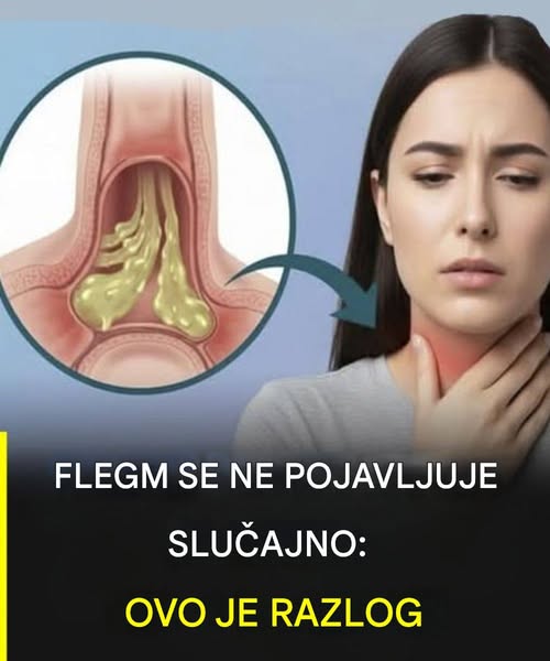 Kako ublažiti sluz u grlu: bezbedni i prirodni saveti za svakodnevno olakšanje - featured image Kako ublažiti sluz u grlu: bezbedni i prirodni saveti za svakodnevno olakšanje - featured image