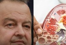 Ivica dačIć ne boluje samo od upale pluća, ovu bolest je ignorisao godinama, a tiho razara organe Ivica dačIć ne boluje samo od upale pluća, ovu bolest je ignorisao godinama, a tiho razara organe - featured image