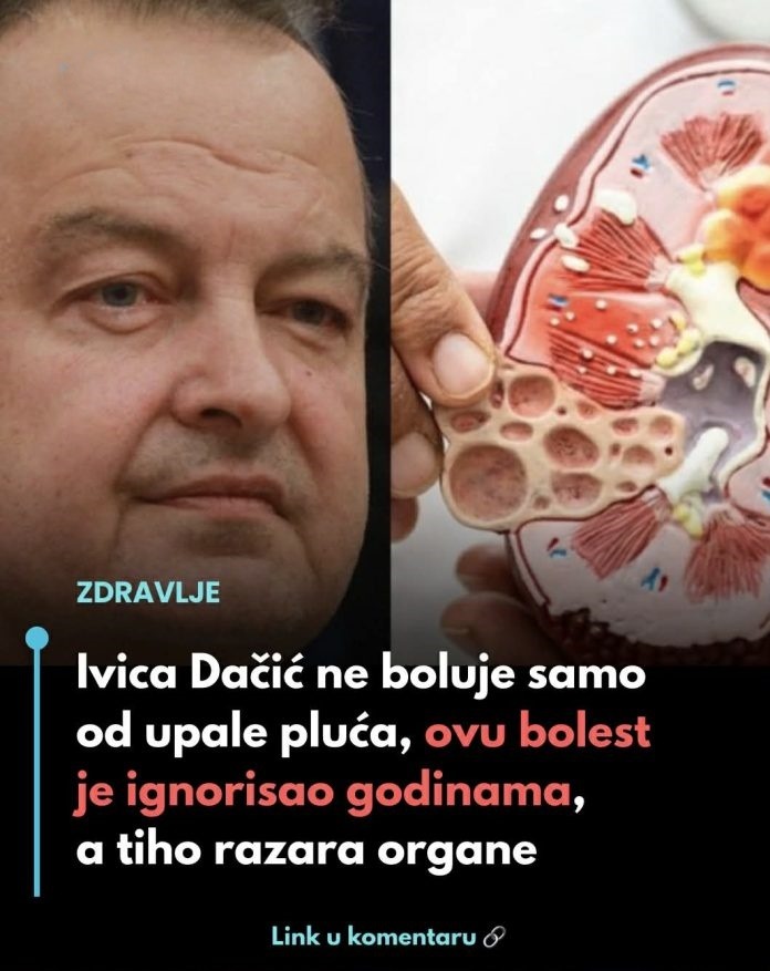 Ivica dačIć ne boluje samo od upale pluća, ovu bolest je ignorisao godinama, a tiho razara organe - featured image Ivica dačIć ne boluje samo od upale pluća, ovu bolest je ignorisao godinama, a tiho razara organe - featured image