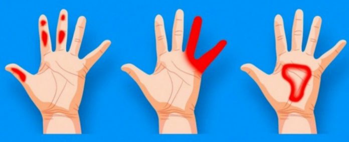 OBAVEZNO OBRATITE PAŽNJU: Ako vam trnu prsti, to može da znači nekoliko stvari, a ovo je uzrok - featured image