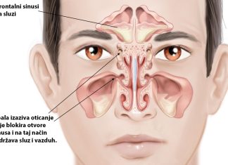 GODINAMA PROVJERENA METODA: Ovako čistite sinuse i uklanjate svu sluz iz nosa! GODINAMA PROVJERENA METODA: Ovako čistite sinuse i uklanjate svu sluz iz nosa! - featured image