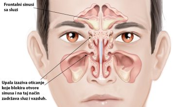 GODINAMA PROVJERENA METODA: Ovako čistite sinuse i uklanjate svu sluz iz nosa! GODINAMA PROVJERENA METODA: Ovako čistite sinuse i uklanjate svu sluz iz nosa! - featured image