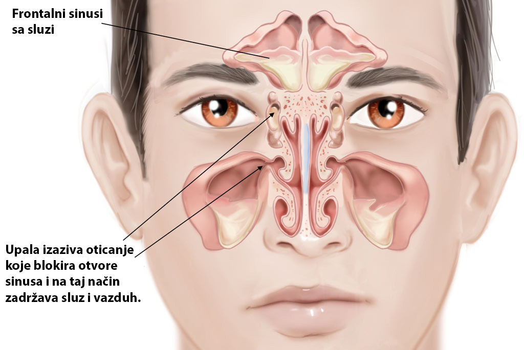 GODINAMA PROVJERENA METODA: Ovako čistite sinuse i uklanjate svu sluz iz nosa! - featured image GODINAMA PROVJERENA METODA: Ovako čistite sinuse i uklanjate svu sluz iz nosa! - featured image