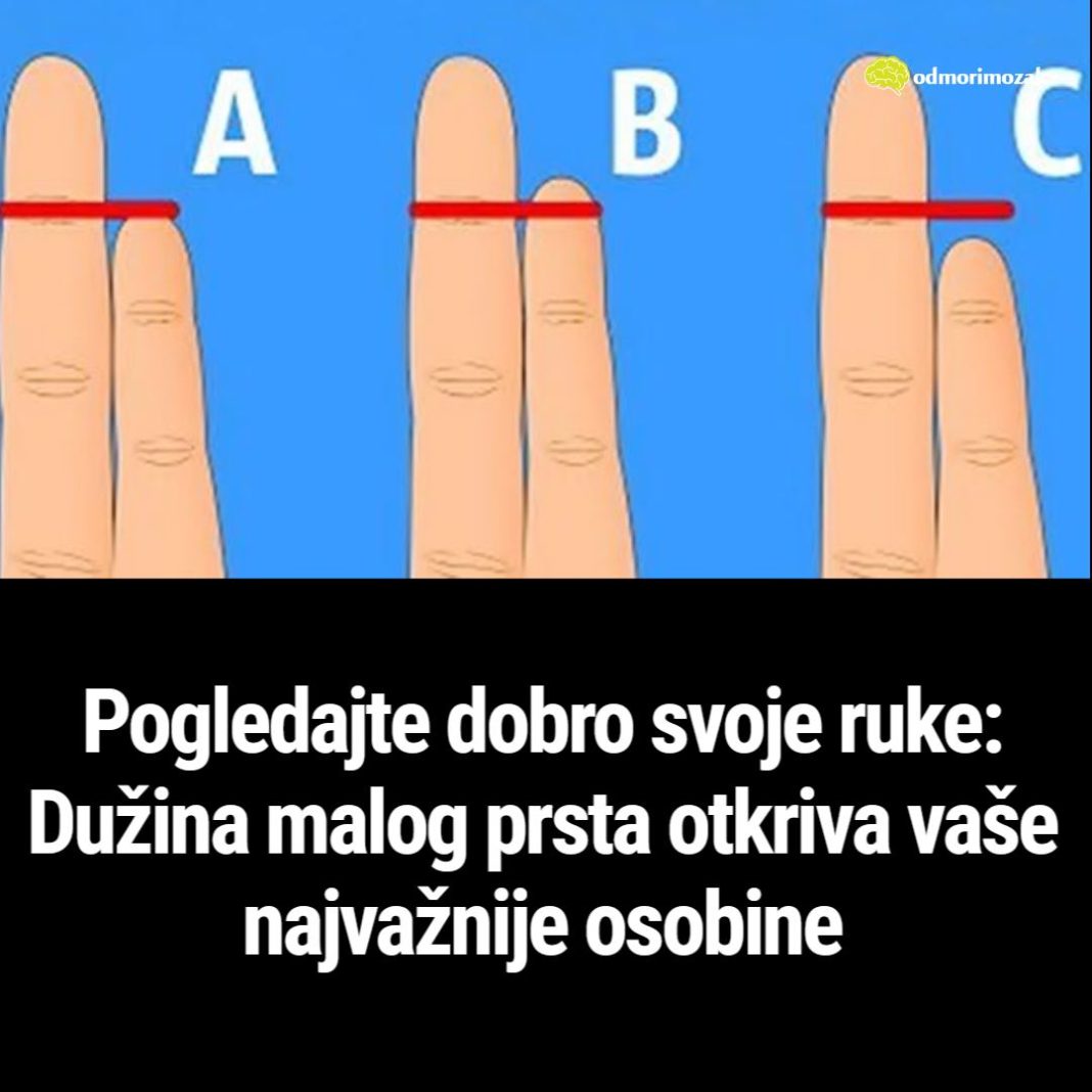 Pogledajte dobro svoje ruke: Dužina malog prsta otkriva vaše najvažnije osobine - featured image