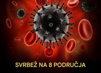 Svrab na 8 mjesta: Upozoravajući znak malignih tumora, broj 7 je najčešći Svrab na 8 mjesta: Upozoravajući znak malignih tumora, broj 7 je najčešći - featured image