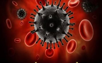 Svrab na 8 mjesta: Upozoravajući znak malignih tumora, broj 7 je najčešći Svrab na 8 mjesta: Upozoravajući znak malignih tumora, broj 7 je najčešći - featured image