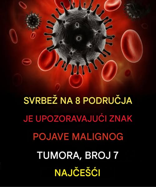 Svrab na 8 mjesta: Upozoravajući znak malignih tumora, broj 7 je najčešći - featured image