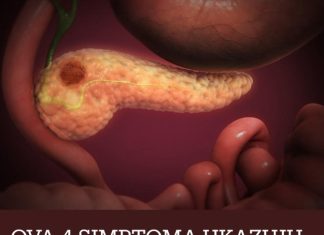 OVA 4 SIMPTOMA UKAZUJU DA IMATE RAK PANKREASA! Svrab je jedan od njih – a tek da čujete ostala tri OVA 4 SIMPTOMA UKAZUJU DA IMATE RAK PANKREASA! Svrab je jedan od njih – a tek da čujete ostala tri - featured image