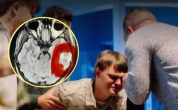 Tumor na mozgu kod 17-godišnjaka čudesno je nestao nakon molitve Tumor na mozgu kod 17-godišnjaka čudesno je nestao nakon molitve - featured image