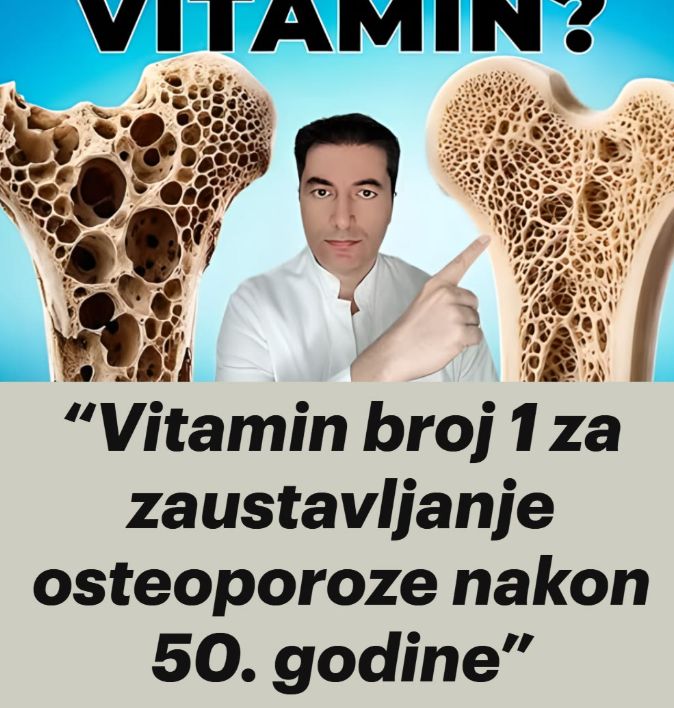 “Vitamin broj 1 za zaustavljanje osteoporoze nakon 50. godine” - featured image “Vitamin broj 1 za zaustavljanje osteoporoze nakon 50. godine” - featured image