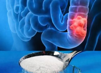 Očistite debelo crijevo slanom vodom: izbacite sve otrove nakon zatvora I to u roku od 30 minuta! (recept) Očistite debelo crijevo slanom vodom: izbacite sve otrove nakon zatvora I to u roku od 30 minuta! (recept) - featured image