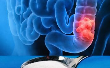 Očistite debelo crijevo slanom vodom: izbacite sve otrove nakon zatvora I to u roku od 30 minuta! (recept) Očistite debelo crijevo slanom vodom: izbacite sve otrove nakon zatvora I to u roku od 30 minuta! (recept) - featured image