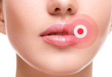 Ako ste ga ikada imali OVO u ustima, trebali bi znati šta je u pitanju, i kako da se toga riješite.. Ako ste ga ikada imali OVO u ustima, trebali bi znati šta je u pitanju, i kako da se toga riješite.. - featured image