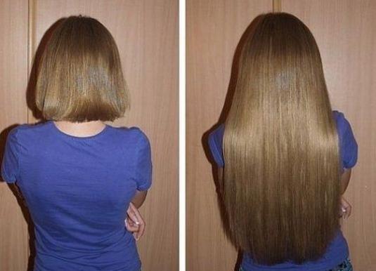 Stavite OVO u šampon kosa će da raste kao luda i biće bujna - featured image