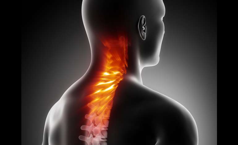 Doktor je pokazao jednostavnu vježbu koja će vratne pršljenove vratiti na svoje mjesto: UKLONIT ĆE I BOL I UMOR! - featured image