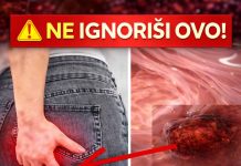 Rak debelog crijeva! UpozoravajućI znakovi I simptomi koje nikada ne smijete ignorirati. Rak debelog crijeva! UpozoravajućI znakovi I simptomi koje nikada ne smijete ignorirati. - featured image