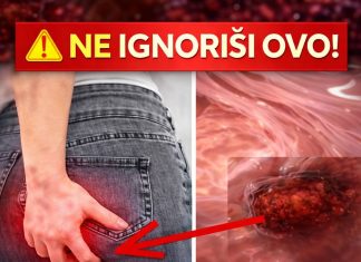 Rak debelog crijeva! UpozoravajućI znakovi I simptomi koje nikada ne smijete ignorirati. Rak debelog crijeva! UpozoravajućI znakovi I simptomi koje nikada ne smijete ignorirati. - featured image