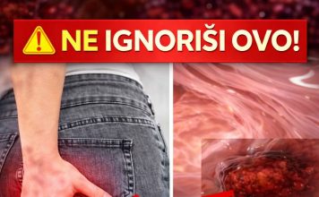 Rak debelog crijeva! UpozoravajućI znakovi I simptomi koje nikada ne smijete ignorirati. Rak debelog crijeva! UpozoravajućI znakovi I simptomi koje nikada ne smijete ignorirati. - featured image