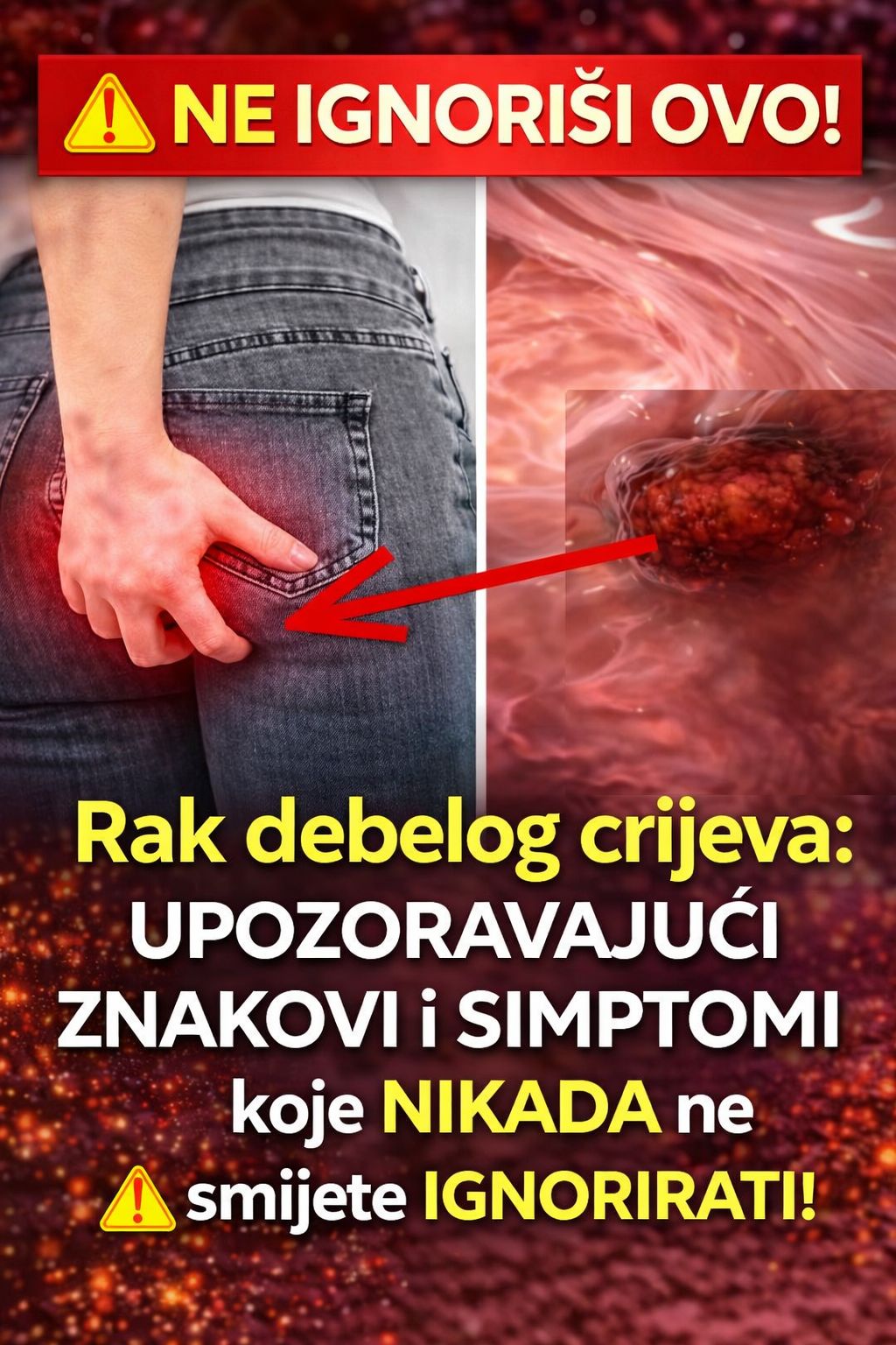 Rak debelog crijeva! UpozoravajućI znakovi I simptomi koje nikada ne smijete ignorirati. - featured image