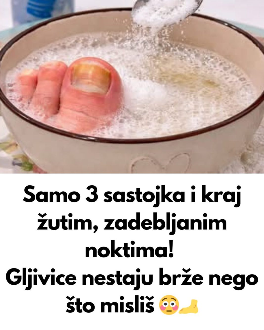 Samo 3 sastojka za žute i zadebljale nokte! GLJIVICE NA NOKTIMA KAO RUKOM ODNESENE… - featured image
