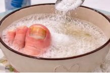 Samo 3 sastojka za žute i zadebljale nokte! GLJIVICE NA NOKTIMA KAO RUKOM ODNESENE… Samo 3 sastojka za žute i zadebljale nokte! GLJIVICE NA NOKTIMA KAO RUKOM ODNESENE… - featured image