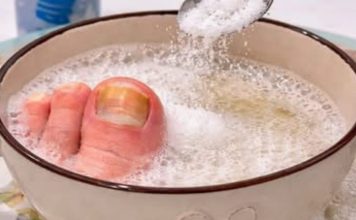 Samo 3 sastojka za žute i zadebljale nokte! GLJIVICE NA NOKTIMA KAO RUKOM ODNESENE… Samo 3 sastojka za žute i zadebljale nokte! GLJIVICE NA NOKTIMA KAO RUKOM ODNESENE… - featured image