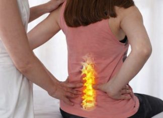 DISKUS HERNIJA PROLAZI I NE VRAĆA SE: Domaći lijek koji OBNAVLJA KIČMU, JAČA JE I LIJEČI DISKUS HERNIJA PROLAZI I NE VRAĆA SE: Domaći lijek koji OBNAVLJA KIČMU, JAČA JE I LIJEČI - featured image