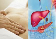 SAČUVAJTE JETRU NA VRIJEME: Evo šta je najviše uništava, a čime je možete obnoviti SAČUVAJTE JETRU NA VRIJEME: Evo šta je najviše uništava, a čime je možete obnoviti - featured image