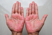 Mast koju svi treba da imamo kod kuće! Upotreba i savjeti Mast koju svi treba da imamo kod kuće! Upotreba i savjeti - featured image