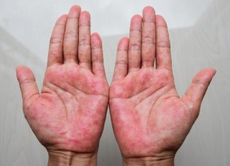 Mast koju svi treba da imamo kod kuće! Upotreba i savjeti Mast koju svi treba da imamo kod kuće! Upotreba i savjeti - featured image