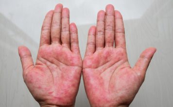 Mast koju svi treba da imamo kod kuće! Upotreba i savjeti Mast koju svi treba da imamo kod kuće! Upotreba i savjeti - featured image