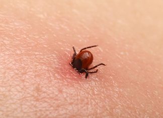 Bezbolno je i nema čupanja: Doktorka otkrila trik kako da se krpelj sam otkači sa kože (video) Bezbolno je i nema čupanja: Doktorka otkrila trik kako da se krpelj sam otkači sa kože (video) - featured image