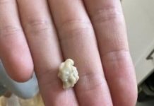 “Neočekivano i šokantno iskustvo: Ono što je izašlo iz mog grla će vas ostaviti bez riječi 😳” “Neočekivano i šokantno iskustvo: Ono što je izašlo iz mog grla će vas ostaviti bez riječi 😳” - featured image