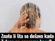 Znate li šta se dešava kada 7 dana ne operemo kosu? Rezultat zaprepastio mnoge Znate li šta se dešava kada 7 dana ne operemo kosu? Rezultat zaprepastio mnoge - featured image