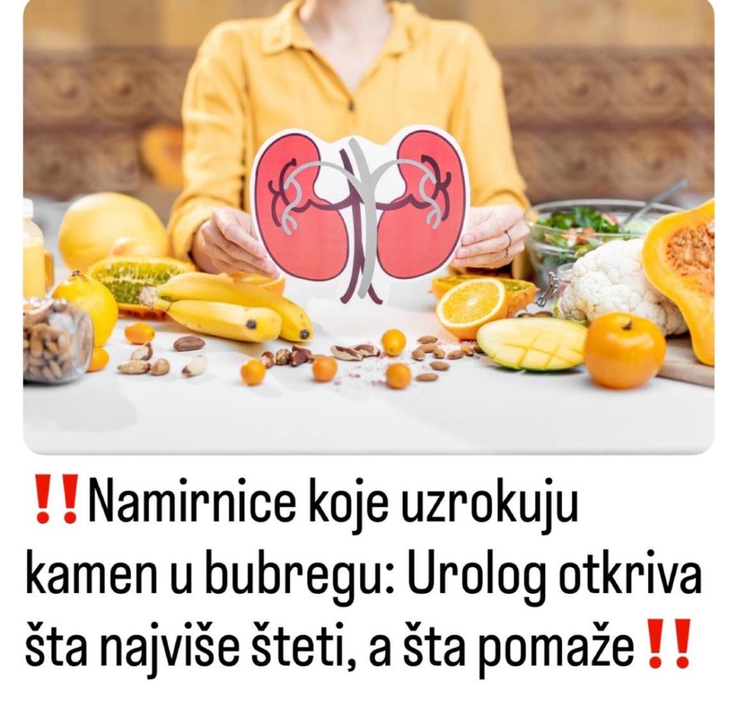 Ovo su namirnice koje uzrokuju kamen u bubregu: Urolog otkriva šta najviše šteti, a šta pomaže - featured image