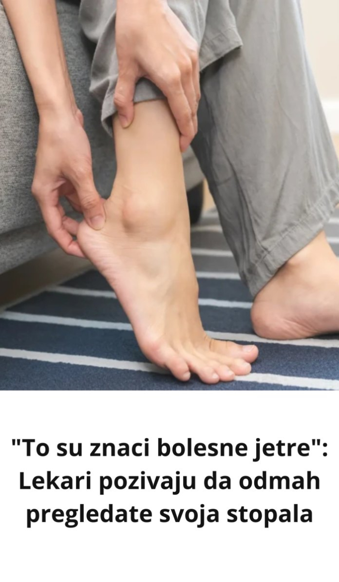 Ovo su znaci bolesne jetre: Odmah pregledate svoja stopala! - featured image
