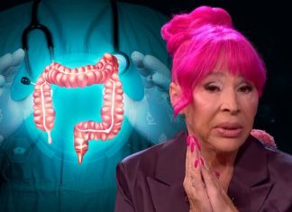 Šta je divertikuloza debelog creva? Uzroci, simptomi i lekcija koju nam je poslala Zorica Brunclik Šta je divertikuloza debelog creva? Uzroci, simptomi i lekcija koju nam je poslala Zorica Brunclik - featured image